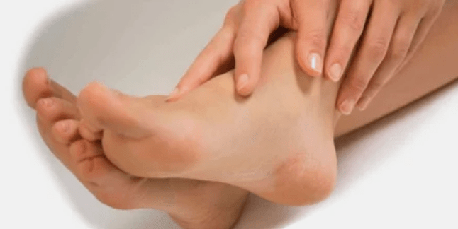 Treatment of the nail fungus