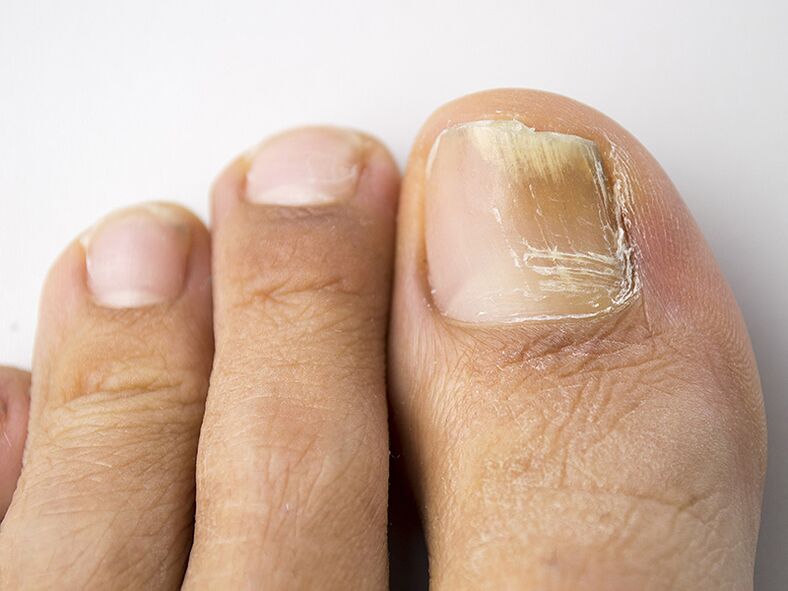 The initial phase of the mushroom