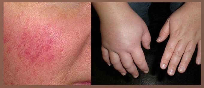 Side effects of drops